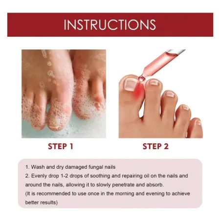 Anti Paronychia Relief Oil - thumb 7