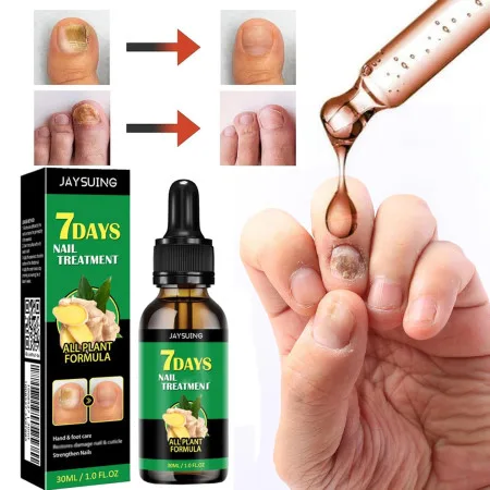 7 DAYS Nail Fungus Treatment Liquid - thumb 3