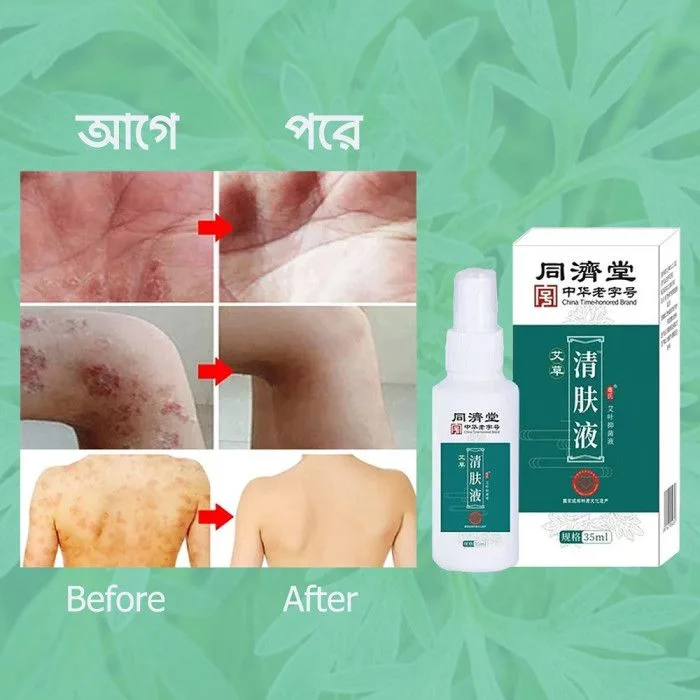 Antimicrobial Skin Solution - thumb 2