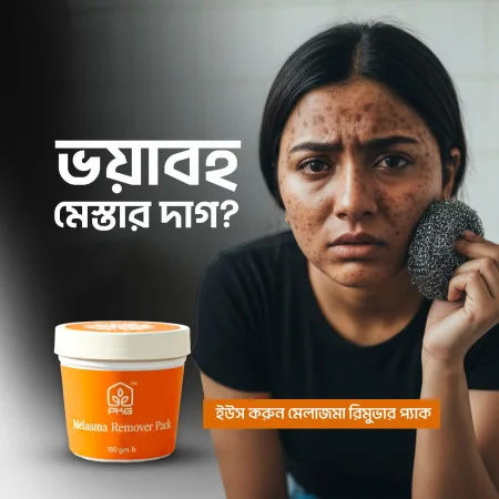 পিকেজি মেলাজমা রিমুভার প্যাক (PKG Melasma Remover Pack) - thumb 2
