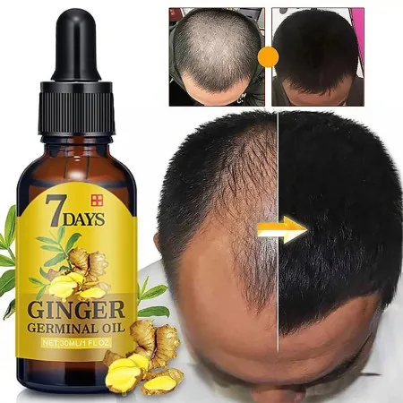 7 Days Ginger Hair Growth - thumb 5