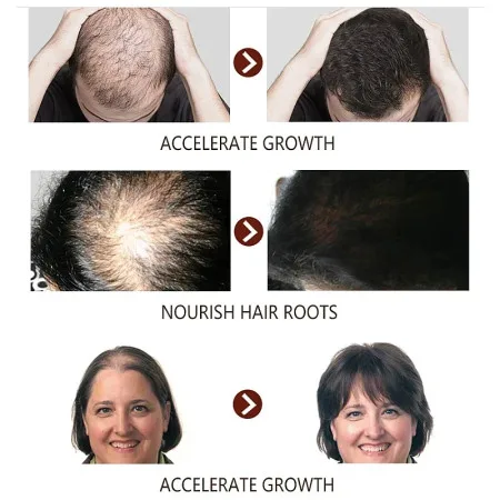 7 Days Ginger Hair Growth - thumb 9